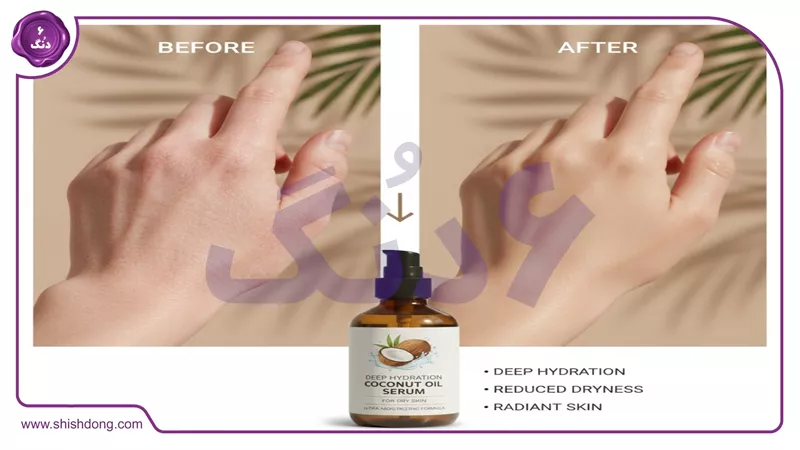 نتایج روغن نارگیل روی پوست خشک