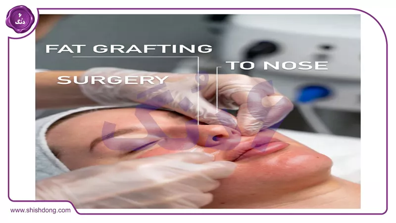 قبل و بعد حجم&zwnj;دهی صورت طبیعی