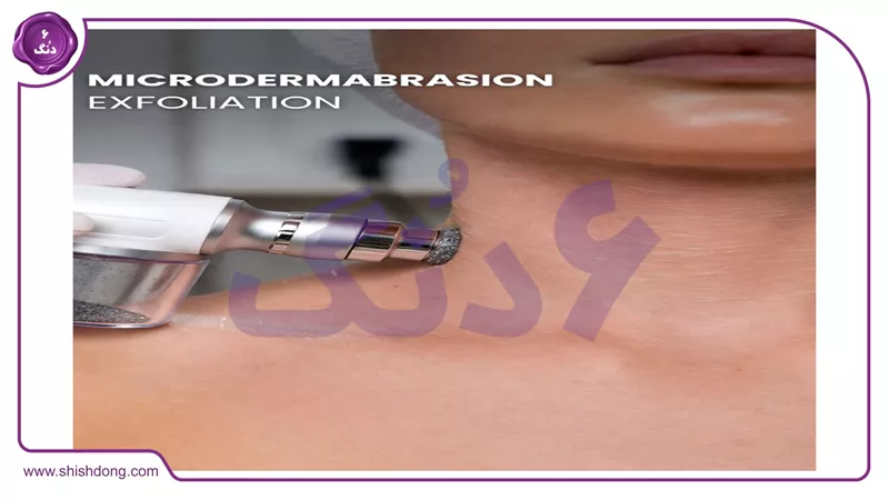 میکرودرم ابریژن در کلینیک تهران