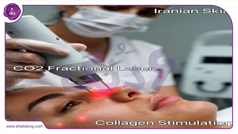 مکانیسم لیزر CO۲ فرکشنال و تحریک کلاژن در پوست ایرانی