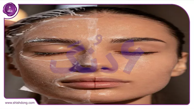 ترندهای لایه برداری پوست ۱۴۰۵