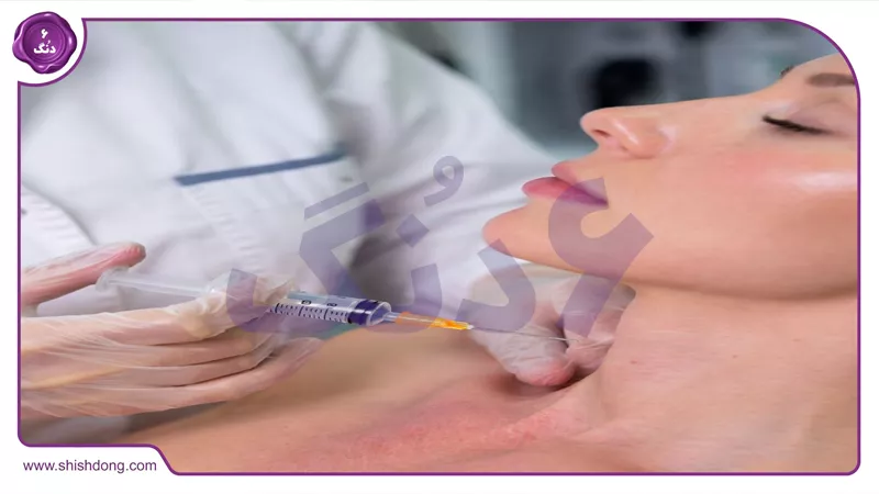 PRP برای غبغب