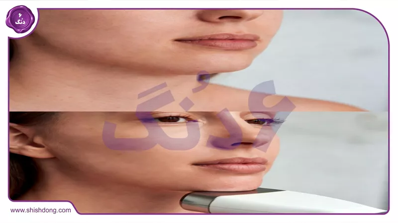 ترندهای زیبایی ۱۴۰۵