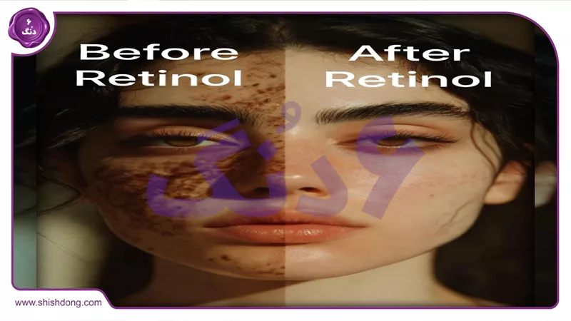 مزایای رتینول برای پوست در ۱۴۰۵
