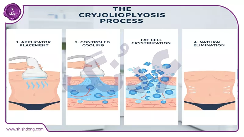 فرآیند انجماد چربی